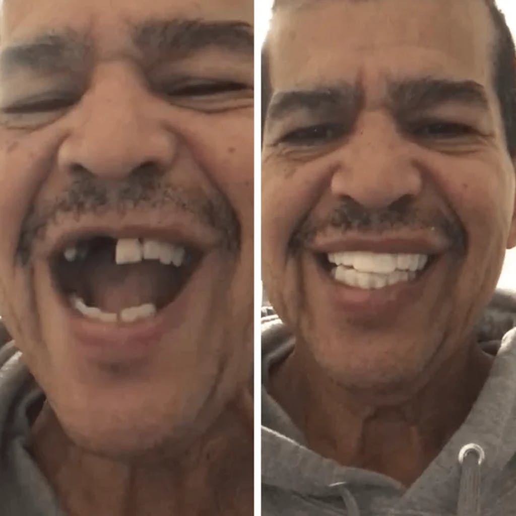 احصل على ابتسامة أجمل